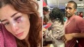 Luchadora mexicana denuncia que su pareja le dio brutal golpiza