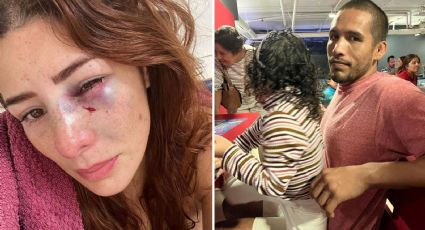 Luchadora mexicana denuncia que su pareja le dio brutal golpiza