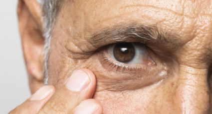 ¿Qué es el glaucoma y por qué se da? Estas son sus causas y consecuencias