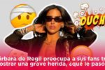 Bárbara de Regil preocupa a sus fans tras mostrar una grave herida, ¿qué le pasó?