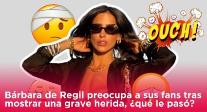 Bárbara de Regil preocupa a sus fans tras mostrar una grave herida, ¿qué le pasó?