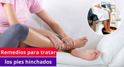 ¿Qué hacer cuando se tiene los pies hinchados? Mejores remedios caseros para desinflamar