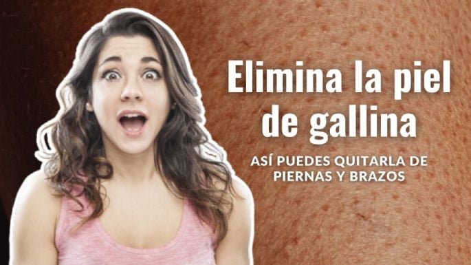 ¿Qué hacer para eliminar la piel de gallina? Así puedes quitarla de piernas y brazos