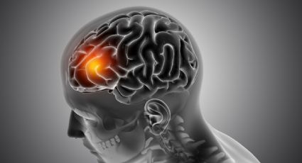 ¿Cómo identificar un microinfarto cerebral? Estos son sus síntomas y causas