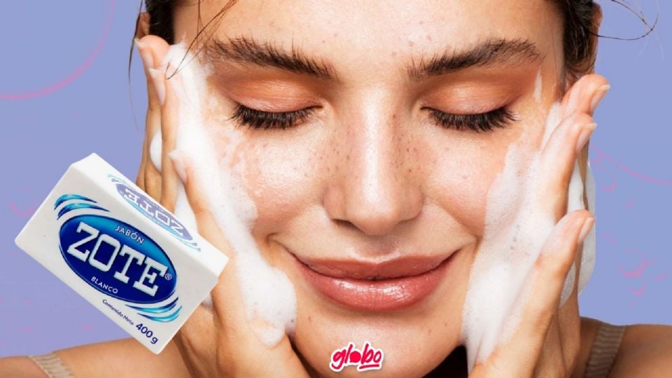 el jabón zote ayuda a combatir el acné.