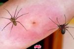 ¿Qué tan peligrosa es la araña violinista y qué hacer si te pica una?	