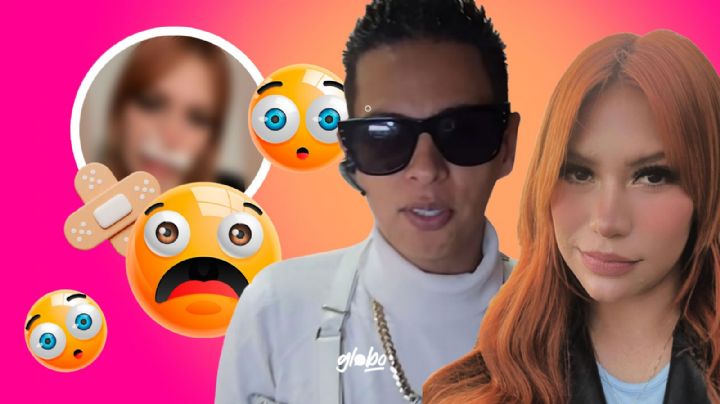 Alex Marín: Su novia Sofía Marín aparece en redes con vendajes en la cara ¿Qué le pasó?