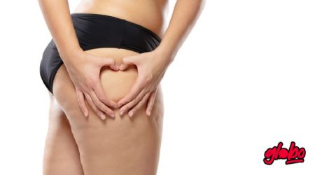 Dile adiós a la celulitis con este truco para que luzcan impecables tus piernas