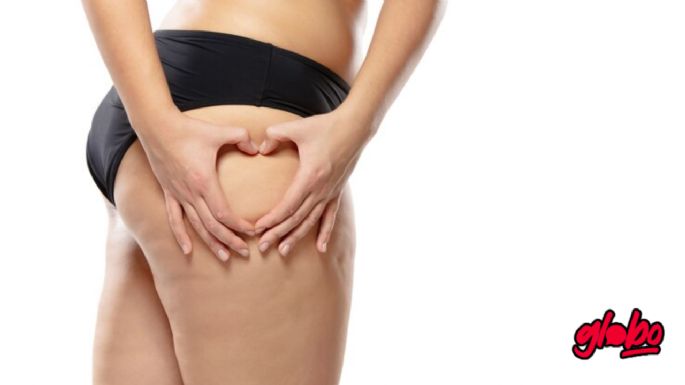Dile adiós a la celulitis con este truco para que luzcan impecables tus piernas