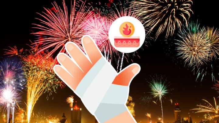 ¿Qué hacer en caso de quemaduras causadas por fuegos artificiales y pirotecnia?
