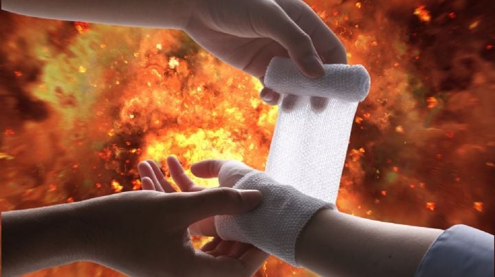 Ignacio Vega muestra lesiones en brazos y cara por explosión en bazar navideño; FOTOS sensibles